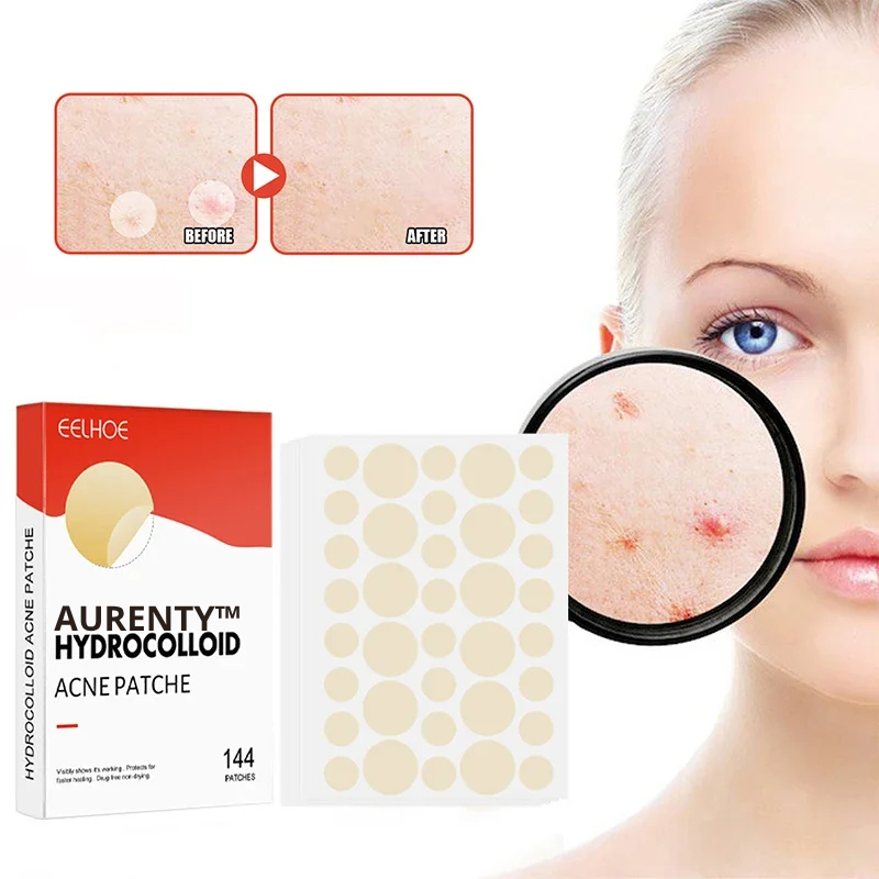 AURENTY™ - Invisible Acne Pimple Patch