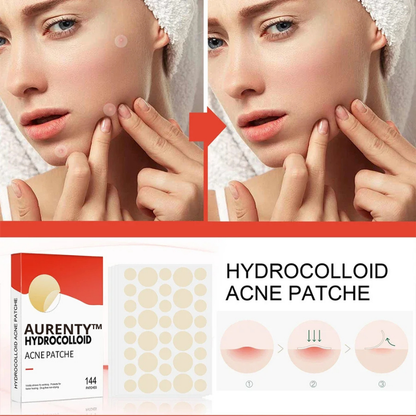 AURENTY™ - Invisible Acne Pimple Patch