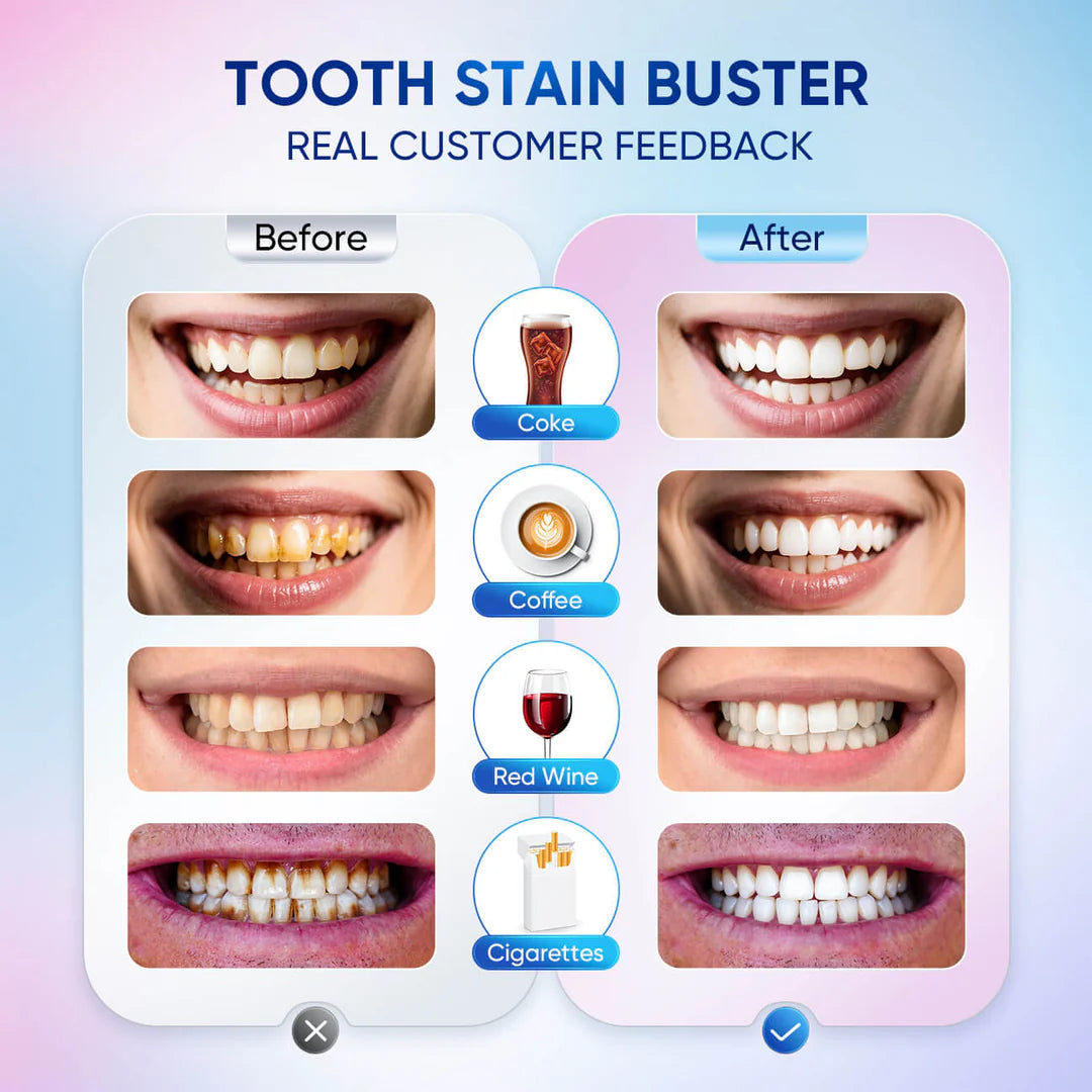 AURENTY™ Instant Whitening Toothpaste